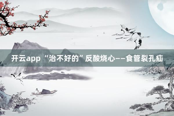 开云app “治不好的”反酸烧心——食管裂孔疝